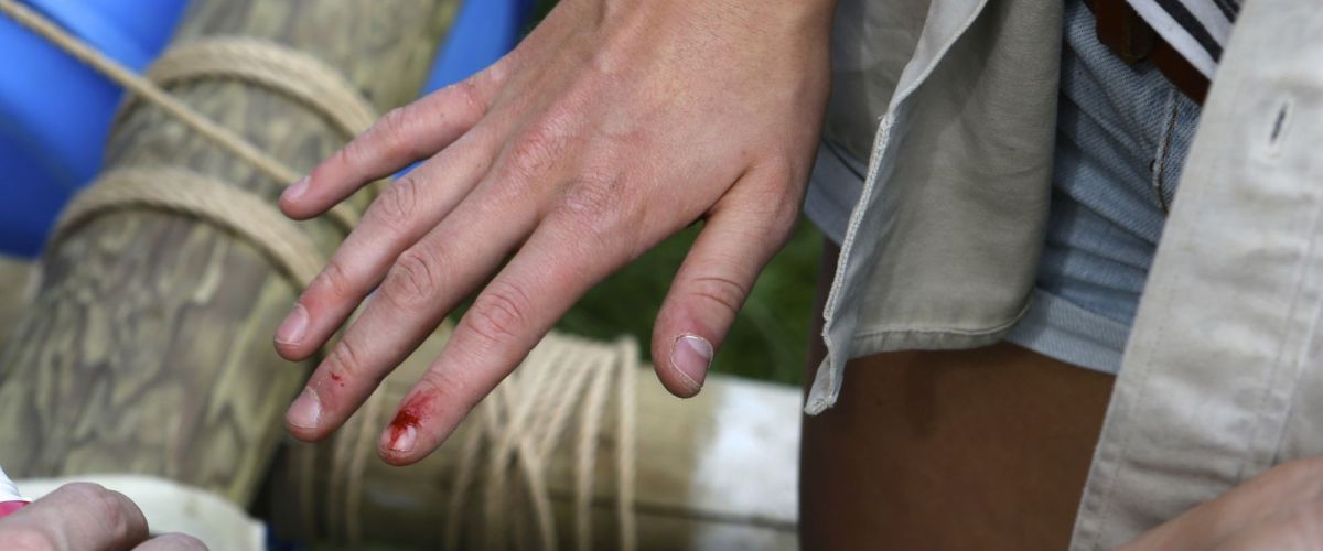 een gewonde vinger wordt verzorgd een gewonde vinger wordt verzorgd